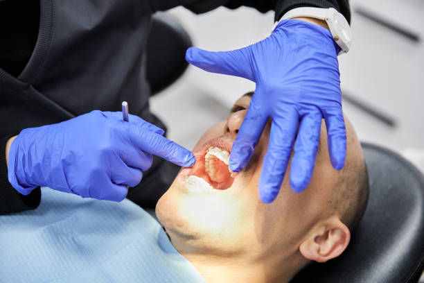 Best Cracked Tooth Emergency Dentist  in Keshore, LA